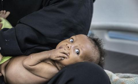 In multiple countries, alarm over hunger crisis rings louder