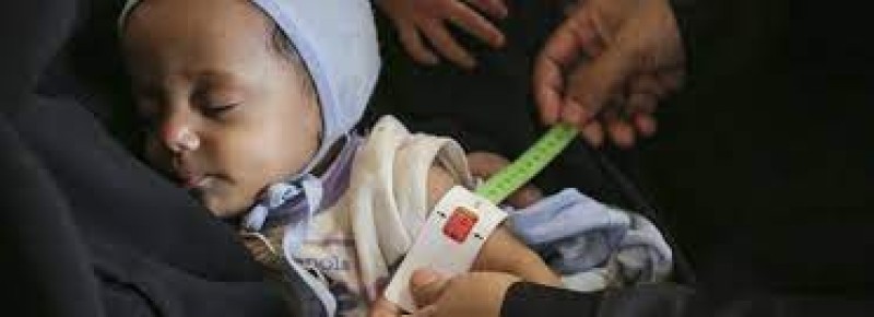 Yemen strengthens coordination to combat malnutrition and food insecurity with new roadmap