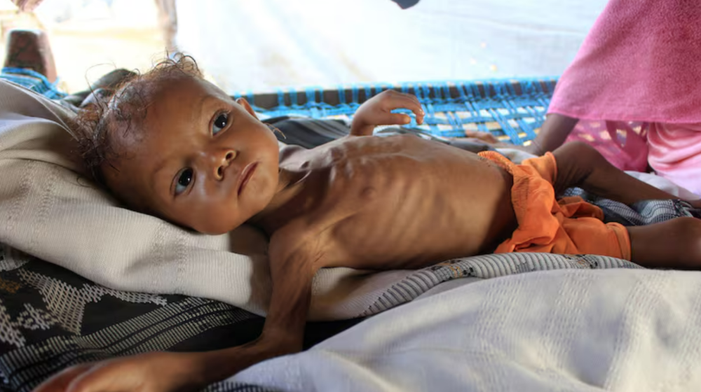 Britain admits its mistakes contributed to Yemen famine