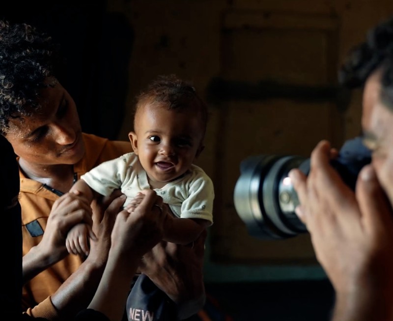 Yemen :UNICEF Reports 500,000 Children Suffering from Severe Malnutrition